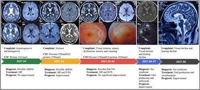 Misdiagnosis of Susac syndrome as demyelinating disease and primary angiitis of the central nervous system: A case report